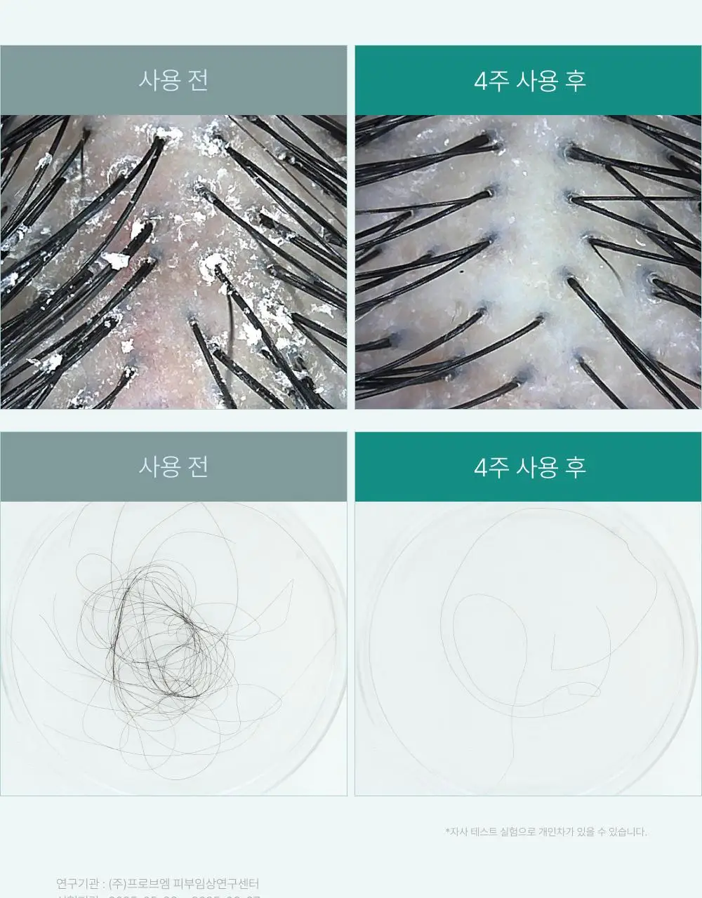 [포켓몬 에디션][비듬/각질케어]릴리이브 스칼프턴 시카 PDRN 브러쉬 앰플 100ml 2종 택1 상세페이지 23
